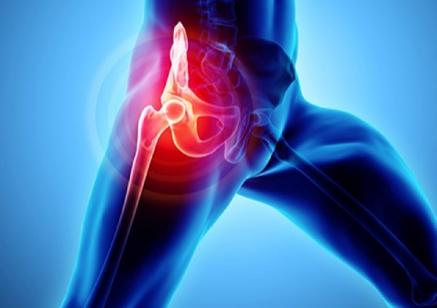 Kalça Ağrısı Tedavisi