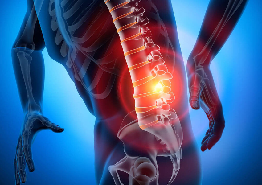 Lomber Disk Hernisi Tedavisi